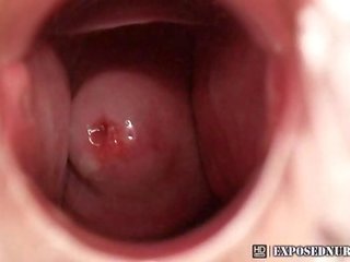 Perawat zaneta speculum masturbation at clinic